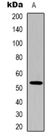 TP53 / p53 Antibody - Western blot analysis of p53 expression in 293T (A) whole cell lysates.