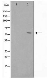 TP53 / p53 Antibody - Western blot of MDA-MB-435 cell lysate using p53 Antibody