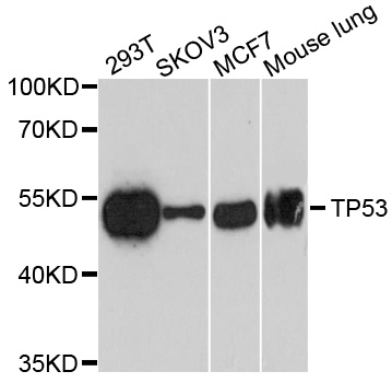 TP53 / p53 Antibody - Western blot analysis of extracts of various cell lines, using TP53 antibody at 1:1000 dilution. The secondary antibody used was an HRP Goat Anti-Mouse IgG (H+L) at 1:10000 dilution. Lysates were loaded 25ug per lane and 3% nonfat dry milk in TBST was used for blocking. An ECL Kit was used for detection and the exposure time was 90s.