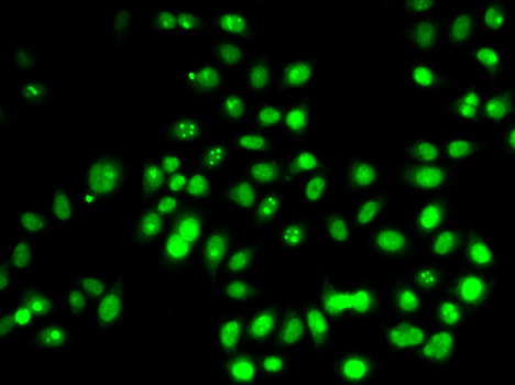 TP53 / p53 Antibody - Immunofluorescence analysis of HeLa cells using TP53 antibody.