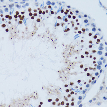 TP53 / p53 Antibody - Immunohistochemistry of paraffin-embedded mouse testis using TP53 antibody at dilution of 1:100 (40x lens).