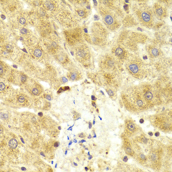TP53 / p53 Antibody - Immunohistochemistry of paraffin-embedded human liver using TP53 antibody at dilution of 1:100 (40x lens).