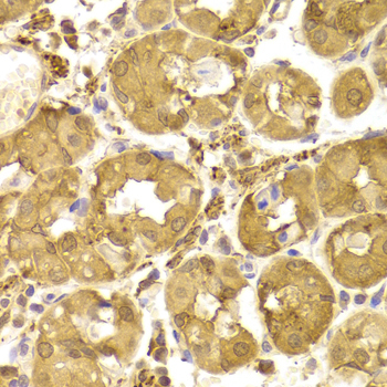 TP53 / p53 Antibody - Immunohistochemistry of paraffin-embedded human stomach using TP53 antibody at dilution of 1:100 (40x lens).