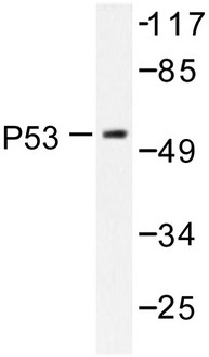 TP53 / p53 Antibody - Western blot of p53 (K386) pAb in extracts from 293 cells treated with Etoposide 25uM 60'.