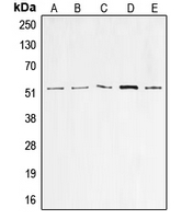 TP53 / p53 Antibody - Western blot analysis of p53 expression in A549 (A); HeLa (B); HepG2 (C); MCF7 (D); A431 (E) whole cell lysates.