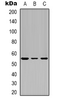 TP53 / p53 Antibody - Western blot analysis of p53 expression in Jurkat (A); HEK293T (B); COS7 (C) whole cell lysates.