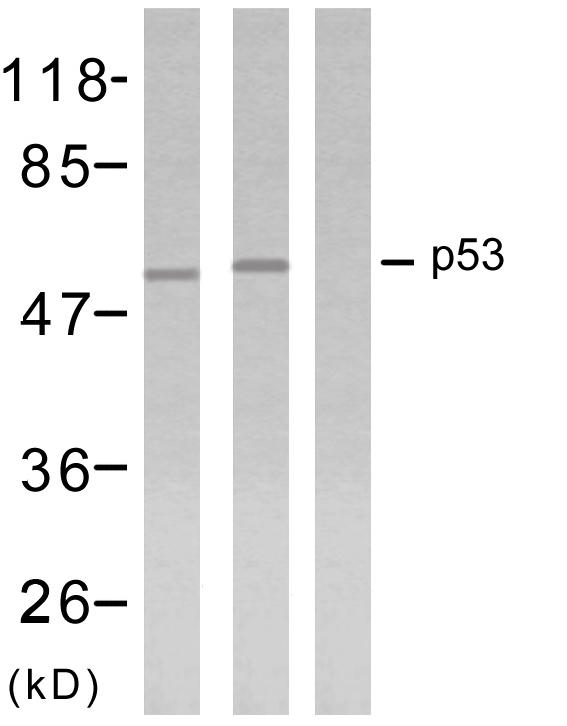 TP53 / p53 Antibody - Western blot analysis using p53 (Ab-18) antibody.