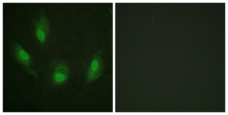 TP53 / p53 Antibody - Peptide - + Immunofluorescence analysis of HeLa cells, using p53 (Ab-392) antibody.