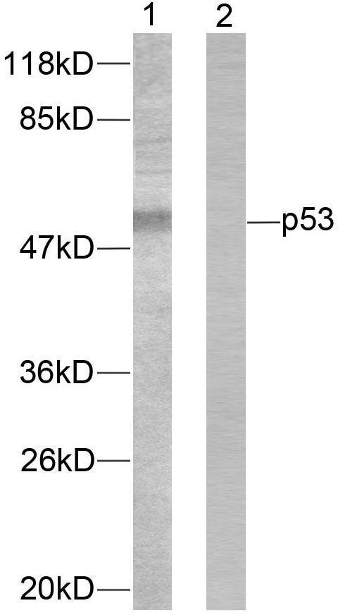 TP53 / p53 Antibody - Western blot analysis of extracts from 293 cells treated with UV. Line1: Using p53(Ab-46) Antibody; Line2: Using the same antibody preincubated with synthesized peptide.