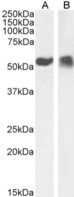 TP53 / p53 Antibody - IF staining of A431 cells.