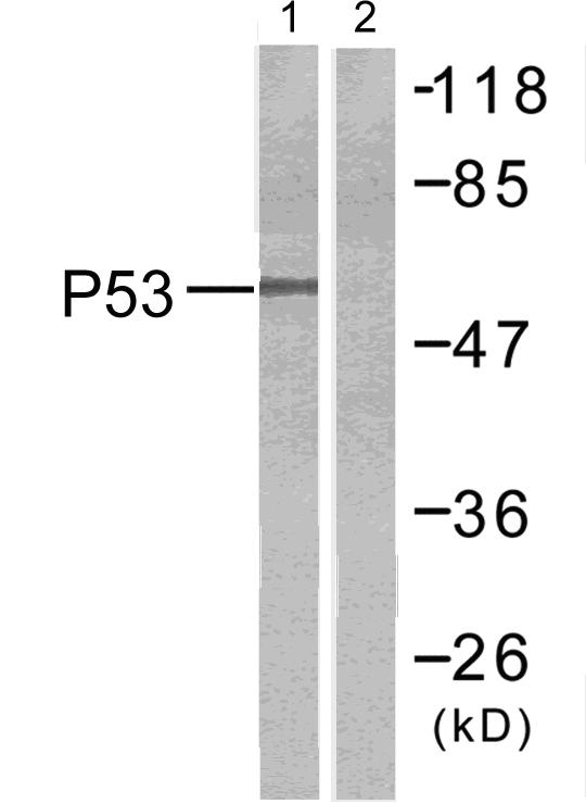 TP53 / p53 Antibody - Western blot analysis of extracts from COS cells untreated or treated with UV, using p53 (Ab-9) antibody ( Line1 and 2).