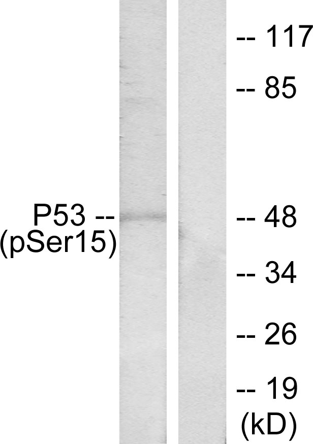 TP53 / p53 Antibody - Western blot analysis of lysates from HeLa cells treated with HU, using p53 (Phospho-Ser15) Antibody. The lane on the right is blocked with the phospho peptide.