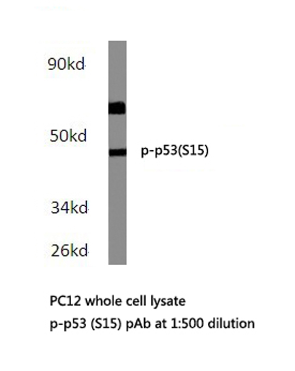 TP53 / p53 Antibody - Western blot of p-p53 (S15) pAb in extracts from PC12 cells.