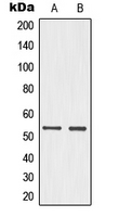 TP53 / p53 Antibody - Western blot analysis of p53 (pS15) expression in HeLa UV-treated (A); PC12 (B) whole cell lysates.