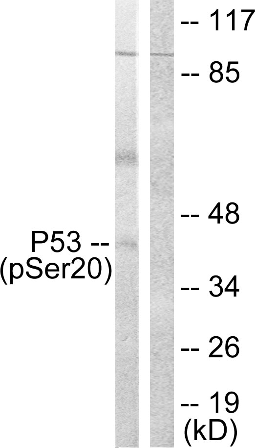 TP53 / p53 Antibody - Western blot analysis of lysates from COS7 cells treated with UV 5', using p53 (Phospho-Ser20) Antibody. The lane on the right is blocked with the phospho peptide.