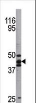 TP53 / p53 Antibody - Western blot of anti-hp53 antibody in A2058 cell line lysate. hp53(arrow) was detected using the purified antibody.