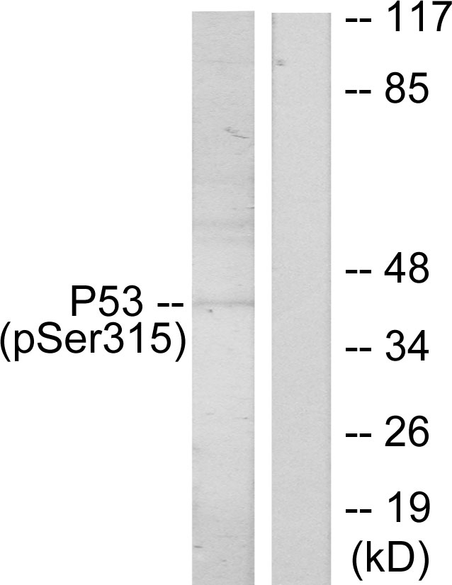TP53 / p53 Antibody - Western blot analysis of lysates from ovary cancer, using p53 (Phospho-Ser315) Antibody. The lane on the right is blocked with the phospho peptide.