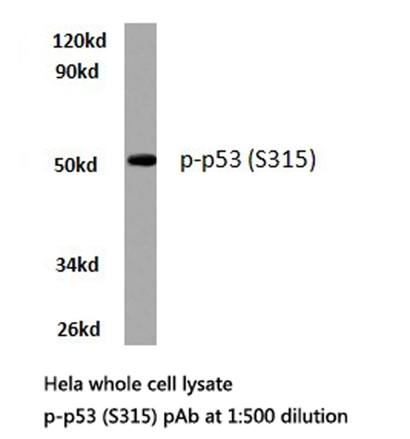 TP53 / p53 Antibody - Western blot of p-p53 (S315) pAb in extracts from HeLa cells.