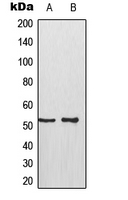 TP53 / p53 Antibody - Western blot analysis of p53 (pS315) expression in HeLa (A); A431 (B) whole cell lysates.