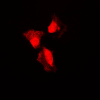 TP53 / p53 Antibody - Immunofluorescent analysis of p53 (pS315) staining in A431 cells. Formalin-fixed cells were permeabilized with 0.1% Triton X-100 in TBS for 5-10 minutes and blocked with 3% BSA-PBS for 30 minutes at room temperature. Cells were probed with the primary antibody in 3% BSA-PBS and incubated overnight at 4 C in a humidified chamber. Cells were washed with PBST and incubated with a DyLight 594-conjugated secondary antibody (red) in PBS at room temperature in the dark. DAPI was used to stain the cell nuclei (blue).