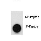 TP53 / p53 Antibody - Dot blot of anti-hp53-S315 Phospho-specific antibody on nitrocellulose membrane. 50ng of Phospho-peptide or Non Phospho-peptide per dot were adsorbed. Antibody working concentrations are 0.5ug per ml.