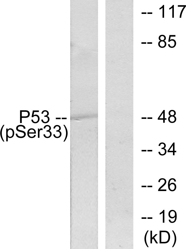 TP53 / p53 Antibody - Western blot analysis of lysates from 293 cells treated with UV, using p53 (Phospho-Ser33) Antibody. The lane on the right is blocked with the phospho peptide.