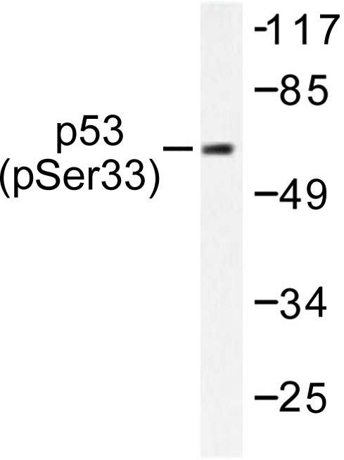 TP53 / p53 Antibody - Western blot of p-p53 (S33) pAb in extracts from 293 cells treated with UV.