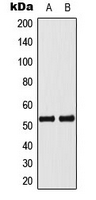 TP53 / p53 Antibody - Western blot analysis of p53 (pS33) expression in MCF7 Actinomycin-treated (A); Jurkat (B) whole cell lysates.