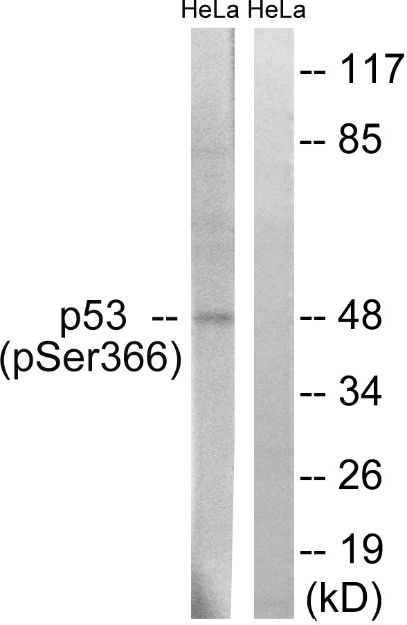 TP53 / p53 Antibody - Western blot analysis of lysates from HeLa cells treated with Adriamycin 0.5ug/ml 24h, using p53 (Phospho-Ser366) Antibody. The lane on the right is blocked with the phospho peptide.