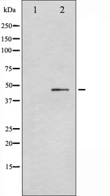 TP53 / p53 Antibody - Western blot analysis of p53 phosphorylation expression in Adriamycin treated HeLa whole cells lysates. The lane on the left is treated with the antigen-specific peptide.