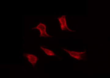 TP53 / p53 Antibody - Staining MDA-MB-435 cells by IF/ICC. The samples were fixed with PFA and permeabilized in 0.1% Triton X-100, then blocked in 10% serum for 45 min at 25°C. The primary antibody was diluted at 1:200 and incubated with the sample for 1 hour at 37°C. An Alexa Fluor 594 conjugated goat anti-rabbit IgG (H+L) Ab, diluted at 1/600, was used as the secondary antibody.