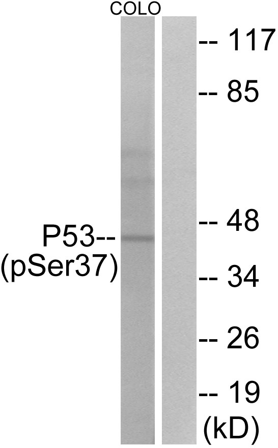 TP53 / p53 Antibody - Western blot analysis of lysates from COLO cells, using p53 (Phospho-Ser37) Antibody. The lane on the right is blocked with the phospho peptide.