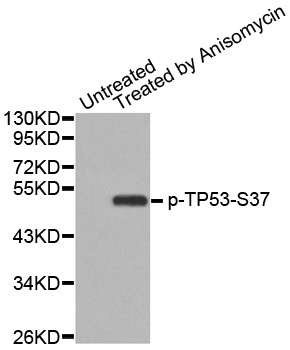 TP53 / p53 Antibody - Western blot analysis of extracts from MCF cells.
