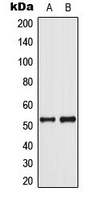 TP53 / p53 Antibody - Western blot analysis of p53 (pS37) expression in COLO205 (A); Jurkat UV-treated (B) whole cell lysates.