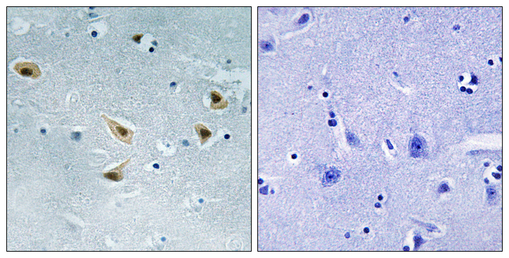 TP53 / p53 Antibody - Immunohistochemistry analysis of paraffin-embedded human brain, using p53 (Phospho-Ser376) Antibody. The picture on the right is blocked with the phospho peptide.