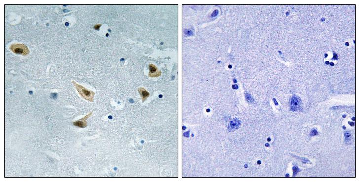 TP53 / p53 Antibody - P-peptide - + Immunohistochemistry analysis of paraffin-embedded human brain tissue using p53 (Phospho-Ser376) antibody. p53 (Phospho-Ser376) antibody reacts with epitope-specific phosphopeptide and corresponding non-phosphopeptide.