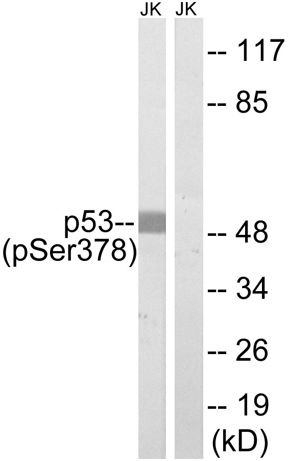 TP53 / p53 Antibody - Western blot analysis of lysates from Jurkat cells treated with UV 15', using p53 (Phospho-Ser378) Antibody. The lane on the right is blocked with the phospho peptide.