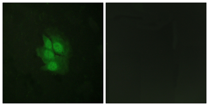 TP53 / p53 Antibody - Immunofluorescence analysis of HeLa cells, using p53 (Phospho-Ser392) Antibody. The picture on the right is blocked with the phospho peptide.