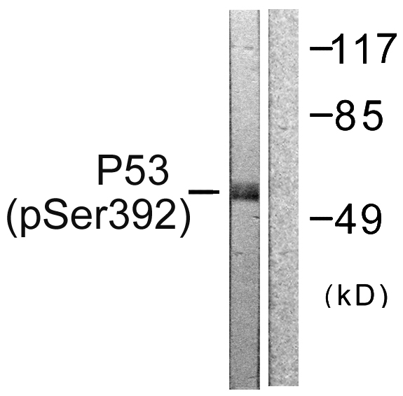 TP53 / p53 Antibody - Western blot analysis of lysates from 293 cells treated with Etoposide 25uM 60', using p53 (Phospho-Ser392) Antibody. The lane on the right is blocked with the phospho peptide.