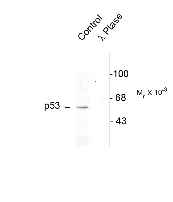 TP53 / p53 Antibody - Western blot of rat brain nuclear fraction lysate showing specific immunolabeling of the ~53k p53 phosphorylated at Ser392 (Control). The phosphospecificity of this labeling is shown in the second lane (lambda-phosphatase: l-Ptase). The blot is identical to the control except that it was incubated in l-Ptase (1200 units for 30 min) before being exposed to the Anti-Ser392 p53. The immunolabeling is completely eliminated by treatment with l-Ptase.