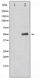 TP53 / p53 Antibody - Western blot of p53 phosphorylation expression in Etoposide treated 293 whole cell lysates,The lane on the left is treated with the antigen-specific peptide.