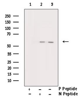 TP53 / p53 Antibody - Western blot analysis of p53 phosphorylation expression in Etoposide treated HeLa whole cells lysates. The lane on the right is treated with the antigen-specific peptide.