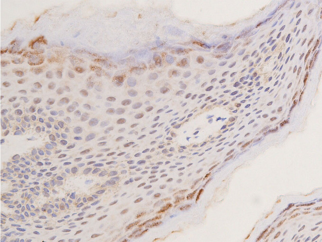 TP53 / p53 Antibody - 1:100 staining human skin tissue by IHC-P. The tissue was formaldehyde fixed and a heat mediated antigen retrieval step in citrate buffer was performed. The tissue was then blocked and incubated with the antibody for 1.5 hours at 22°C. An HRP conjugated goat anti-rabbit antibody was used as the secondary.