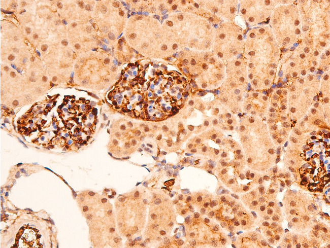 TP53 / p53 Antibody - 1:100 staining mouse kidney tissue by IHC-P. The tissue was formaldehyde fixed and a heat mediated antigen retrieval step in citrate buffer was performed. The tissue was then blocked and incubated with the antibody for 1.5 hours at 22°C. An HRP conjugated goat anti-rabbit antibody was used as the secondary.