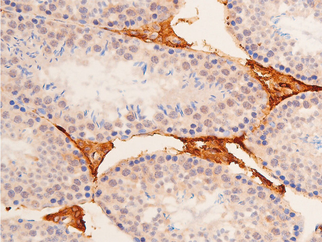 TP53 / p53 Antibody - 1:100 staining mouse testis tissue by IHC-P. The tissue was formaldehyde fixed and a heat mediated antigen retrieval step in citrate buffer was performed. The tissue was then blocked and incubated with the antibody for 1.5 hours at 22°C. An HRP conjugated goat anti-rabbit antibody was used as the secondary.