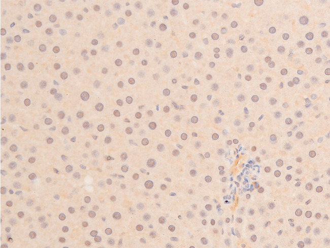 TP53 / p53 Antibody - 1:100 staining mouse liver tissue by IHC-P. The tissue was formaldehyde fixed and a heat mediated antigen retrieval step in citrate buffer was performed. The tissue was then blocked and incubated with the antibody for 1.5 hours at 22°C. An HRP conjugated goat anti-rabbit antibody was used as the secondary.