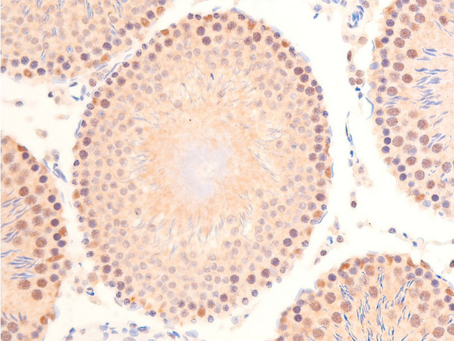 TP53 / p53 Antibody - 1:100 staining rat testis tissue by IHC-P. The tissue was formaldehyde fixed and a heat mediated antigen retrieval step in citrate buffer was performed. The tissue was then blocked and incubated with the antibody for 1.5 hours at 22°C. An HRP conjugated goat anti-rabbit antibody was used as the secondary.
