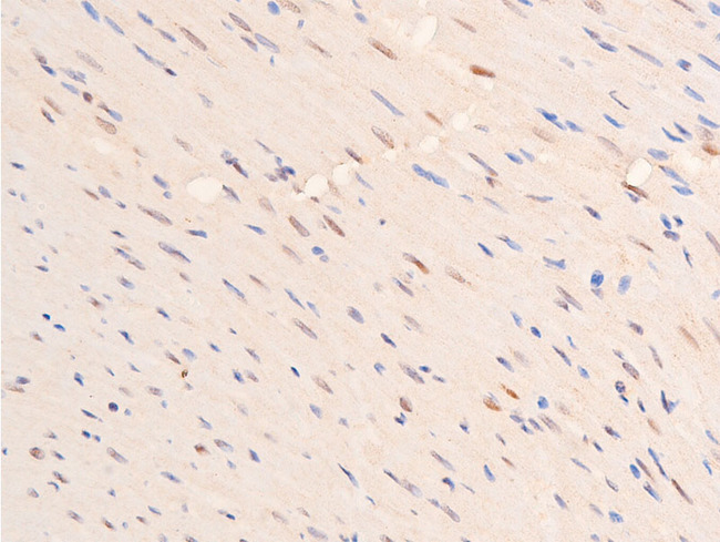 TP53 / p53 Antibody - 1:100 staining rat heart tissue by IHC-P. The tissue was formaldehyde fixed and a heat mediated antigen retrieval step in citrate buffer was performed. The tissue was then blocked and incubated with the antibody for 1.5 hours at 22°C. An HRP conjugated goat anti-rabbit antibody was used as the secondary.