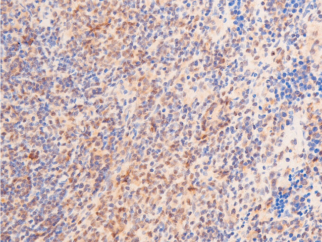 TP53 / p53 Antibody - 1:100 staining rat spleen tissue by IHC-P. The tissue was formaldehyde fixed and a heat mediated antigen retrieval step in citrate buffer was performed. The tissue was then blocked and incubated with the antibody for 1.5 hours at 22°C. An HRP conjugated goat anti-rabbit antibody was used as the secondary.