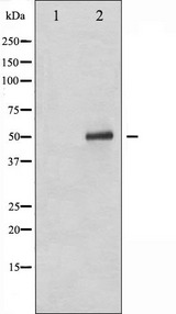TP53 / p53 Antibody - Western blot analysis of p53 phosphorylation expression in Etoposide treated 293 whole cells lysates. The lane on the left is treated with the antigen-specific peptide.